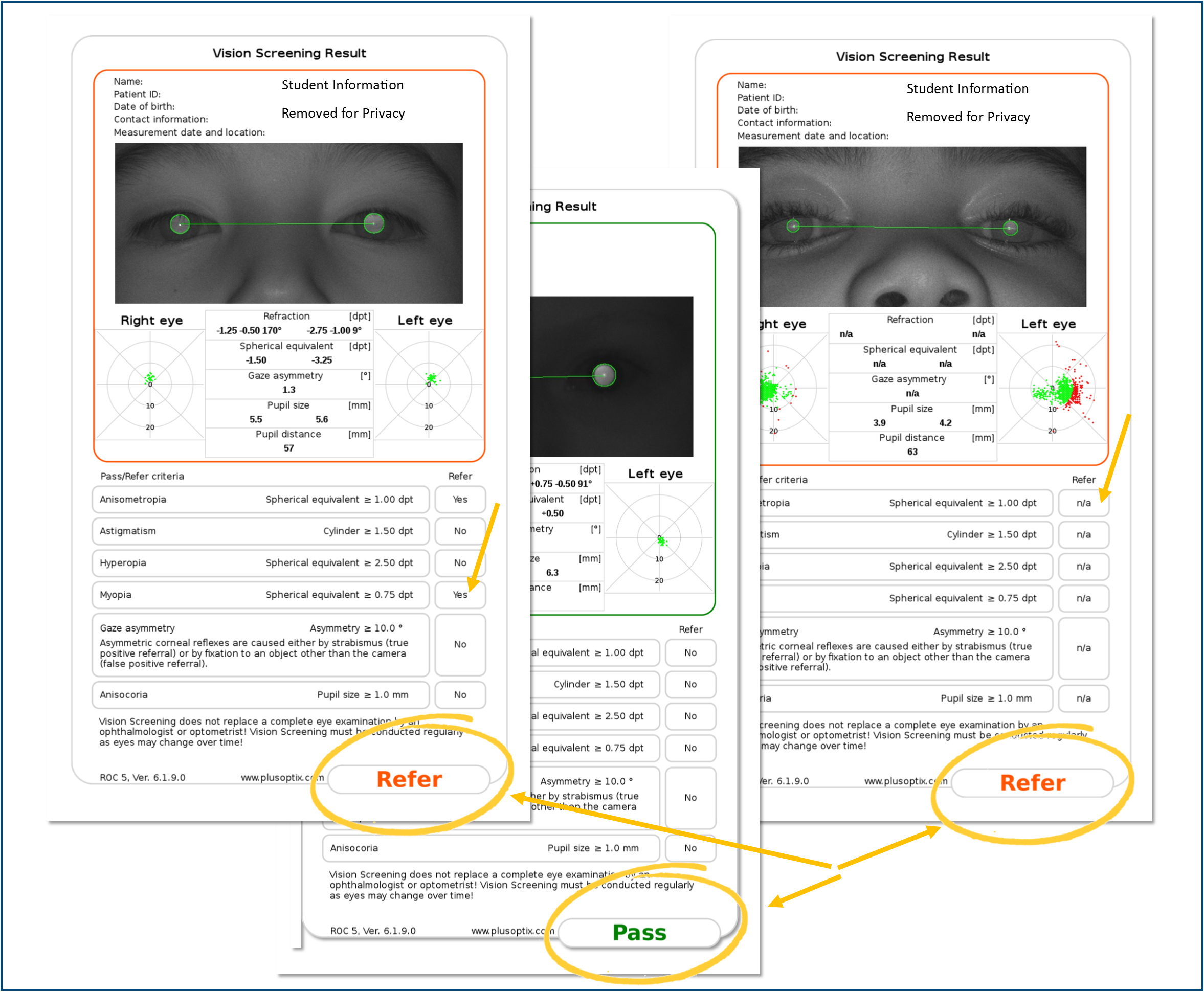 Vision test sample – Vision in Pregnancy